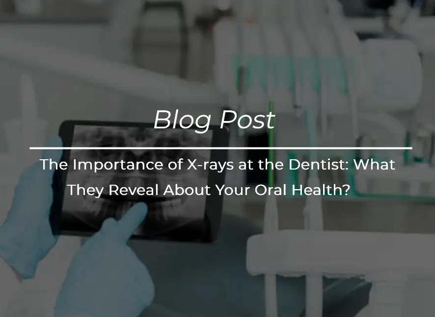 The Importance of X-rays at the Dentist