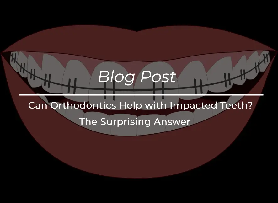 Can Orthodontics Help with Impacted Teeth