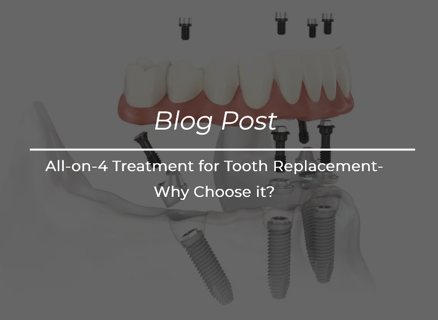 All-on-4 Treatment for Tooth