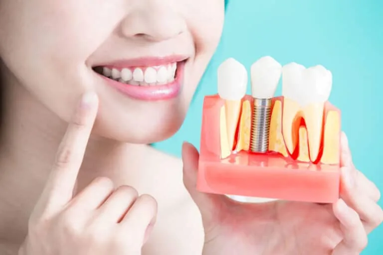 Dental Implants Sydney